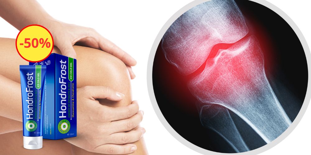 Hondrofrost România  Site Oficial